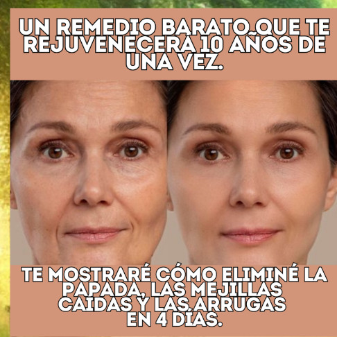 example of an anti-wrinkle creative